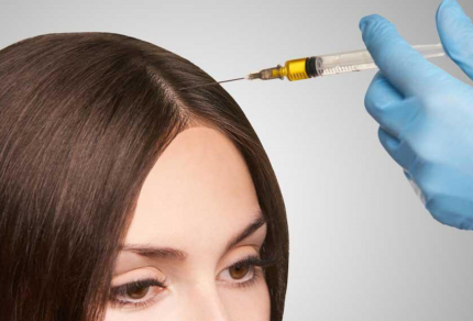 Everything You Need To Know About The PRP Treatment For Hair Loss