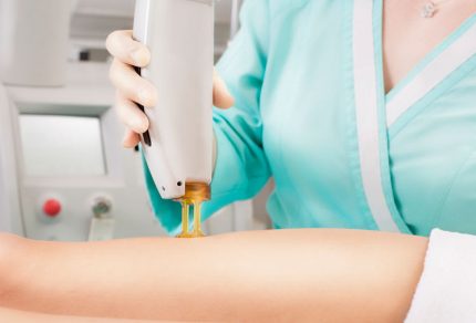 Here’s What Happens Before, During, & After Your Laser Hair Removal Treatments