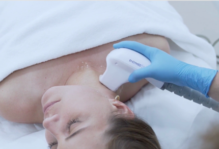 Radio Frequency Therapy: A New Skin Tightening Method - Treatments & Benefits
