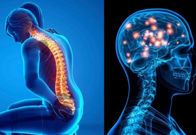 Chiropractic Functional Neurology - A combined problem related to your mind and body