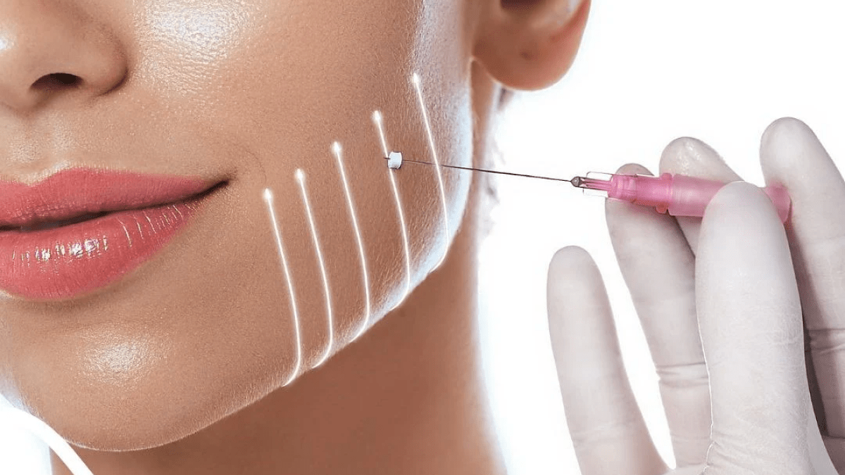 benefits of dermal fillers