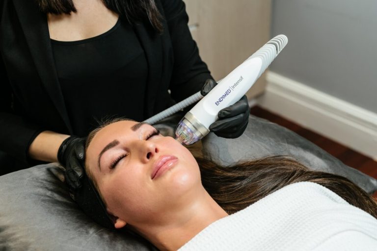 micro needling in dubai