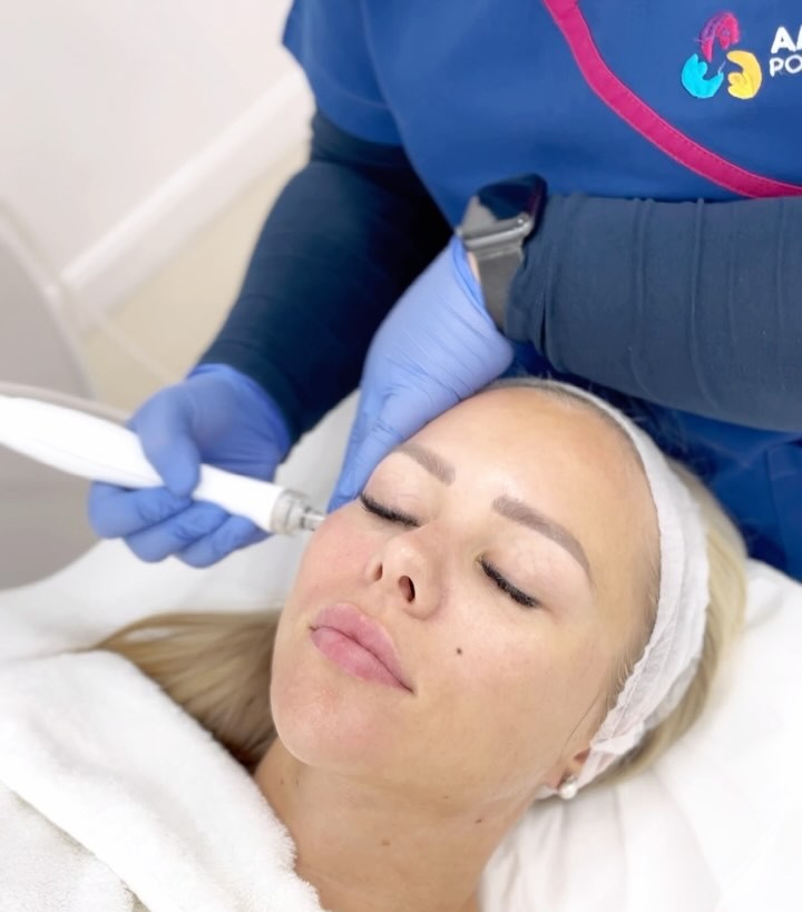 hydrafacial treatment in dubai