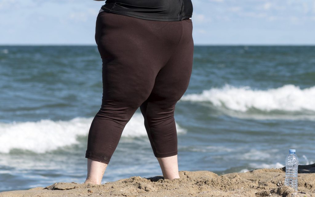 lipedema in summer