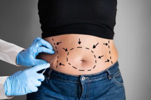 how is liposuction done