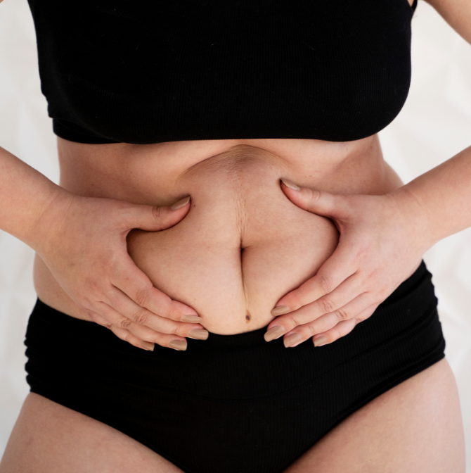 mommy makeover surgery in dubai