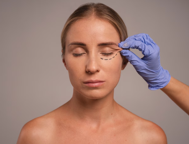 blepharoplasty in dubai