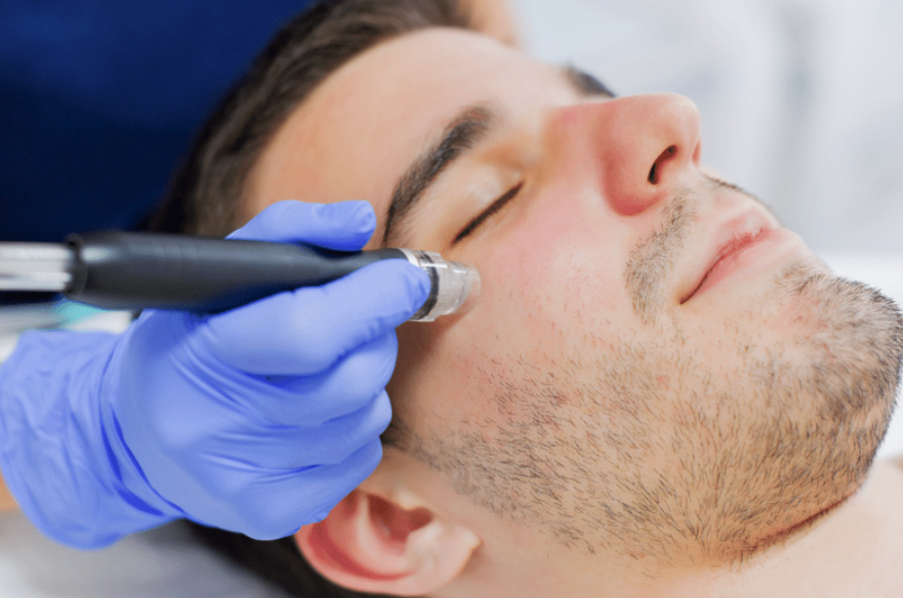 hydrafacial for men in Dubai